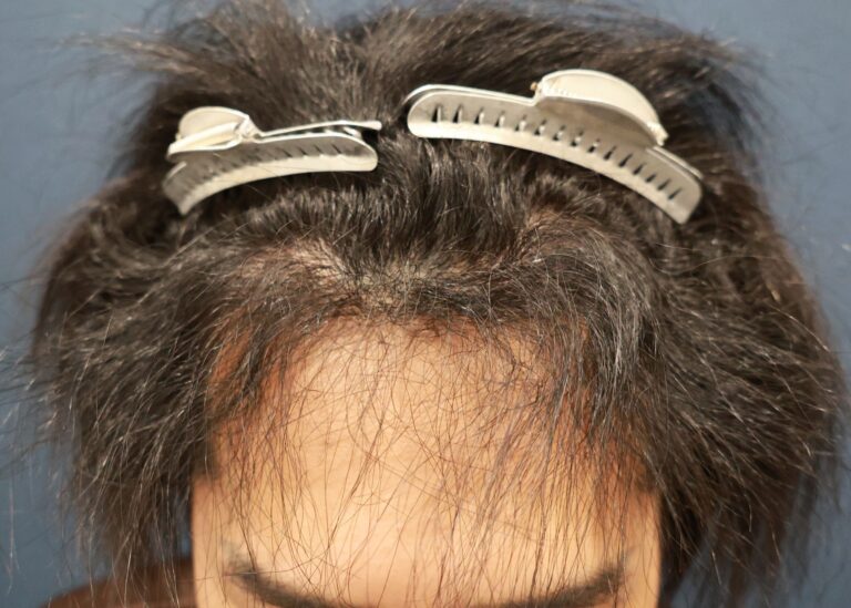 症例写真