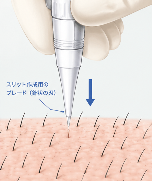 東京の高密度植毛のスリット