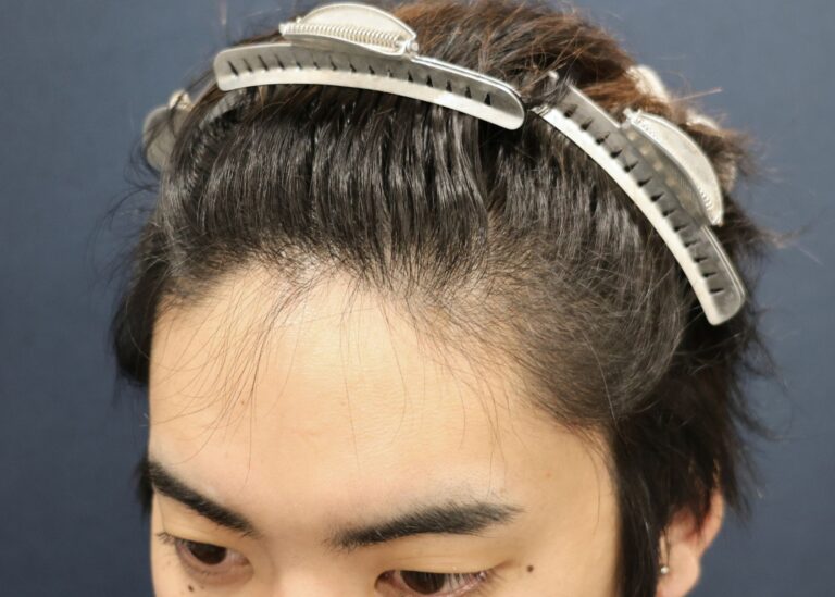 症例写真